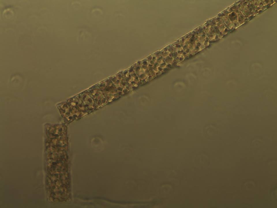 microscopic photo of Odontella aurita